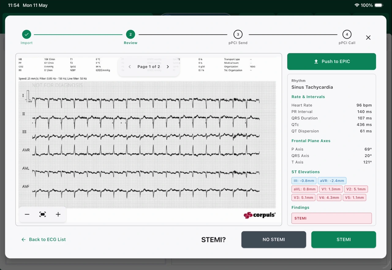 ParaNote ECG review and STEMI pathway screen
